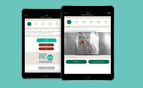 St. Jude Medical app is a success at the EuroPCR fair in Paris